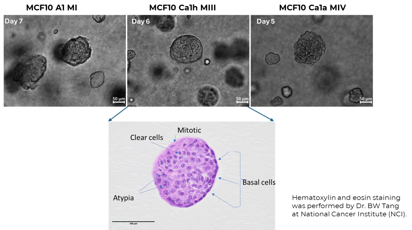 No. 0001 PGmatrixTM  Enables Physiologically Relevant 3D Tumor Organoids